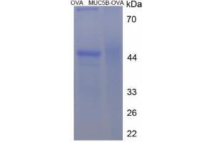 Image no. 2 for Mucin 5 Subtype B (MUC5B) (AA 4202-4210) peptide (Ovalbumin) (ABIN5666276) (Mucin 5 Subtype B (MUC5B) (AA 4202-4210) peptide (Ovalbumin))
