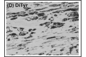 Immunohistochemistry (IHC) image for anti-Dityrosine (DT) antibody (ABIN492669) (Dityrosine Antikörper)