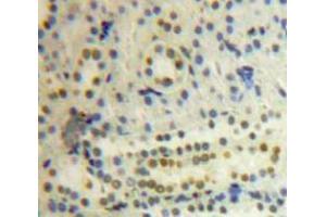 IHC-P analysis of Kidney tissue, with DAB staining. (PSMC3 Antikörper  (AA 2-439))