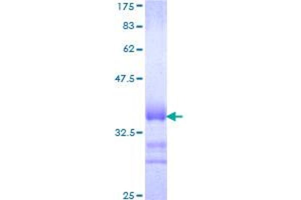 SOX12 Protein (AA 252-313) (GST tag)