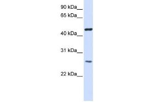 Western Blotting (WB) image for anti-Transmembrane Protein 127 (TMEM127) antibody (ABIN2459095)