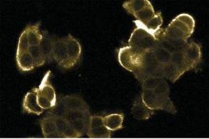 Immunofluorescence staining of MCF7 cells. (ERK2 Antikörper  (AA 219-358))