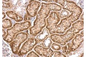 IHC-P Image VHL antibody detects VHL protein at cytosol on mouse kidney by immunohistochemical analysis. (VHL Antikörper)
