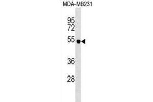 Western Blotting (WB) image for anti-Spinster Homolog 2 (SPNS2) antibody (ABIN2999753)