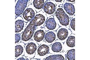 IHC analysis of SAE1 using anti-SAE1 antibody (ABIN7601346). (SAE1 Antikörper  (AA 33-299))