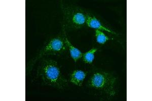 IF analysis of Alanine Transaminase/Gpt using anti-Alanine Transaminase/Gpt antibody (ABIN7600506).
