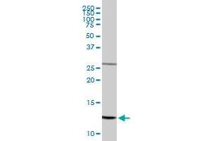 Western Blotting (WB) image for anti-NADH Dehydrogenase (Ubiquinone) Fe-S Protein 5, 15kDa (NADH-Coenzyme Q Reductase) (NDUFS5) (AA 1-106) antibody (ABIN518261)
