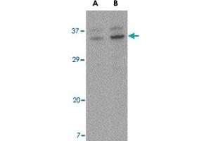Western blot analysis of ORAI3 in A-20 cell lysate with ORAI3 polyclonal antibody  at (A) 2 and (B) 4 ug/mL .