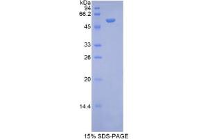 N-Acetyl alpha-D-Glucosaminidase protein