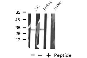 Western blot analysis of extracts from Jurkat/293 cells, using KCNK7 antibody.
