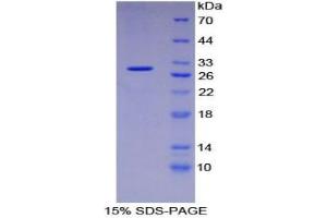 SDS-PAGE analysis of Human Intercellular Adhesion Molecule 3 Protein. (ICAM-3/CD50 Protein)