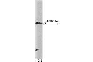Western blot analysis of JAK1 on Jurkat cell lysate. (JAK1 Antikörper  (AA 551-766))