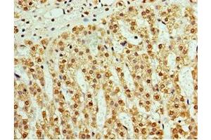 Immunohistochemistry (IHC) image for anti-ATPase Family, AAA Domain Containing 3B (ATAD3B) (AA 1-240) antibody (ABIN7145043)