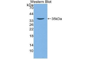 Western Blotting (WB) image for anti-Defensin beta 2 (BD-2) (AA 24-64) antibody (ABIN1172176) (beta 2 Defensin Antikörper  (AA 24-64))