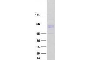 Validation with Western Blot (ACVR1 Protein (Transcript Variant 2) (Myc-DYKDDDDK Tag))