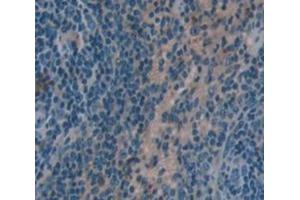Used in DAB staining on fromalin fixed paraffin- embedded Kidney tissue (HCK Antikörper  (AA 2-524))