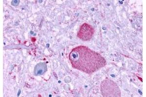 Immunohistochemistry (Formalin/PFA-fixed paraffin-embedded sections) of human brain, neurons and glia with GPR37 polyclonal antibody . (GPR37 Antikörper  (Extracellular Domain))