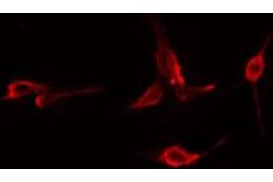 Immunofluorescence (fixed cells) (IF/ICC) image for anti-G Protein-Coupled Receptor, Family C, Group 5, Member B (GPRC5B) (Internal Region) antibody (ABIN6258198)