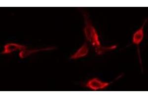 ABIN6276024 staining  Hela cells by IF/ICC. (GPRC5B Antikörper  (Internal Region))