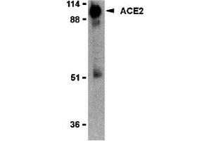 Western Blotting (WB) image for anti-Angiotensin I Converting Enzyme 2 (ACE2) (Middle Region 2) antibody (ABIN1031195) (ACE2 Antikörper  (Middle Region 2))