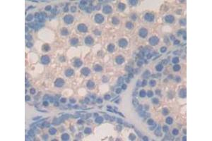 Immunohistochemistry (IHC) image for anti-Guanine Nucleotide Binding Protein (G Protein), alpha 11 (Gq Class) (GNA11) (AA 1-359) antibody (ABIN1868197)