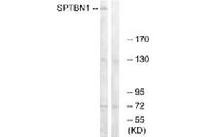 Western blot analysis of extracts from COLO cells, using SPTBN1 Antibody.