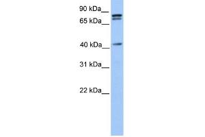 WB Suggested Anti-SUZ12 Antibody Titration:  0.