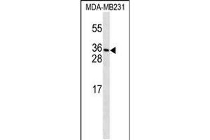 Western blot analysis in MDA-MB231 cell line lysates (35ug/lane). (PDGFC Antikörper  (N-Term))