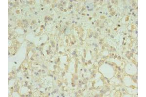 Immunohistochemistry of paraffin-embedded human adrenal gland tissue using ABIN7173203 at dilution of 1:100 (TMEM33 Antikörper  (AA 177-247))