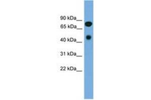 Image no. 1 for anti-Receptor-Interacting Serine-threonine Kinase 4 (RIPK4) (AA 179-228) antibody (ABIN6744810) (RIPK4 Antikörper  (AA 179-228))