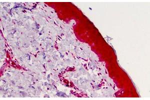 Human Skin: Formalin-Fixed, Paraffin-Embedded (FFPE) (Caspase 4 Antikörper)