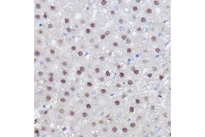 Immunohistochemistry of paraffin-embedded rat liver using PPARD Rabbit pAb (ABIN6132423, ABIN6146002, ABIN6146003 and ABIN6221300) at dilution of 1:100 (40x lens). (PPARD Antikörper  (AA 102-361))