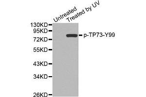 Western blot analysis of extracts from 293 cells, using Phospho-TP73-Y99 antibody. (Tumor Protein p73 Antikörper  (pTyr99))
