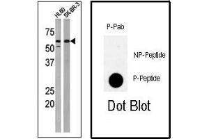 Image no. 1 for anti-Protein Kinase, Membrane Associated tyrosine/threonine 1 (PKMYT1) (pThr495) antibody (ABIN358168) (PKMYT1 Antikörper  (pThr495))