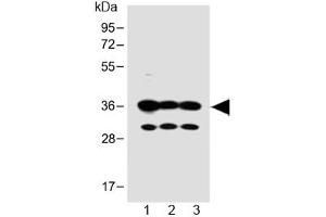 Western blot testing of human 1) SH-SY5Y, 2) PANC-1 and 3) MCF-7 cell lysate with OR5V1 antibody at 1:1000.