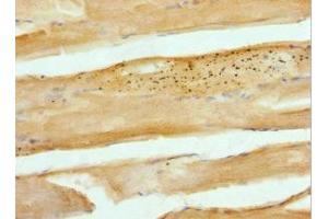 Immunohistochemistry of paraffin-embedded human skeletal muscle tissue using ABIN7146447 at dilution of 1:100 (CAMK2B Antikörper  (AA 1-300))