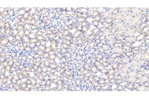 Detection of IL1RA in Mouse Kidney Tissue using Polyclonal Antibody to Interleukin 1 Receptor Antagonist (IL1RA) (IL1RN Antikörper  (AA 27-178))