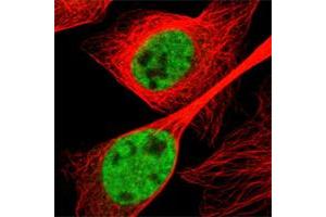 Immunofluorescent staining of human cell line U-2 OS shows positivity in nucleus but not nucleoli. (SMEK2 Antikörper)