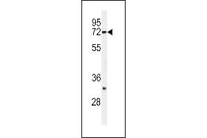 Western blot analysis of HRD1 Antibody (N-term) (ABIN650702 and ABIN2839220) in SK-BR-3 cell line lysates (35 μg/lane).