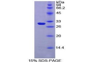 SDS-PAGE analysis of Rat MPG1 Protein. (MPEG1 Protein)