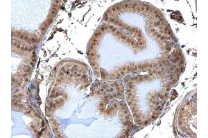 IHC-P Image DDB1 antibody detects DDB1 protein at nucleus and cytosol on mouse prostate by immunohistochemical analysis. (DDB1 Antikörper  (C-Term))