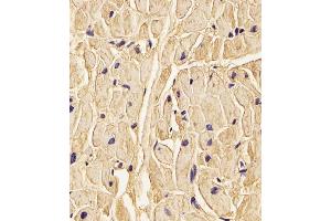 Immunohistochemistry (Paraffin-embedded Sections) (IHC (p)) image for anti-Procollagen-Lysine,2-Oxoglutarate 5-Dioxygenase 1 (PLOD1) (AA 66-94), (N-Term) antibody (ABIN656585)