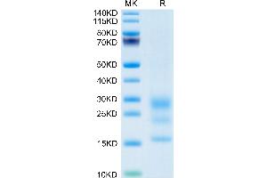 SDS-PAGE (SDS) image for Bone Marrow Stromal Cell Antigen 2 (BST2) (AA 52-152) protein (His tag) (ABIN7273995)