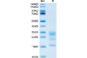 Mouse BST2 on Tris-Bis PAGE under reduced condition. (BST2 Protein (AA 52-152) (His tag))