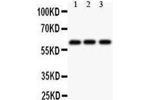 Observed bind size: 61KD (Perforin 1 Antikörper  (AA 175-555))