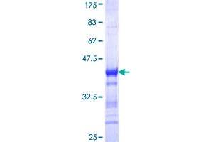 NRIP1 Protein (AA 1051-1158) (GST tag)