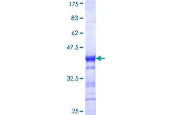 NRIP1 Protein (AA 1051-1158) (GST tag)