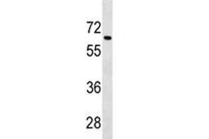 Tgfbr2 antibody western blot analysis in 293 lysate.