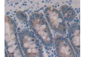 Detection of GAL2 in Rat Small intestine Tissue using Polyclonal Antibody to Galectin 2 (GAL2) (Gallinacin-2 (GAL2) (AA 1-130) Antikörper)