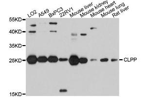 Western blot analysis of extracts of various cells, using CLPP antibody.